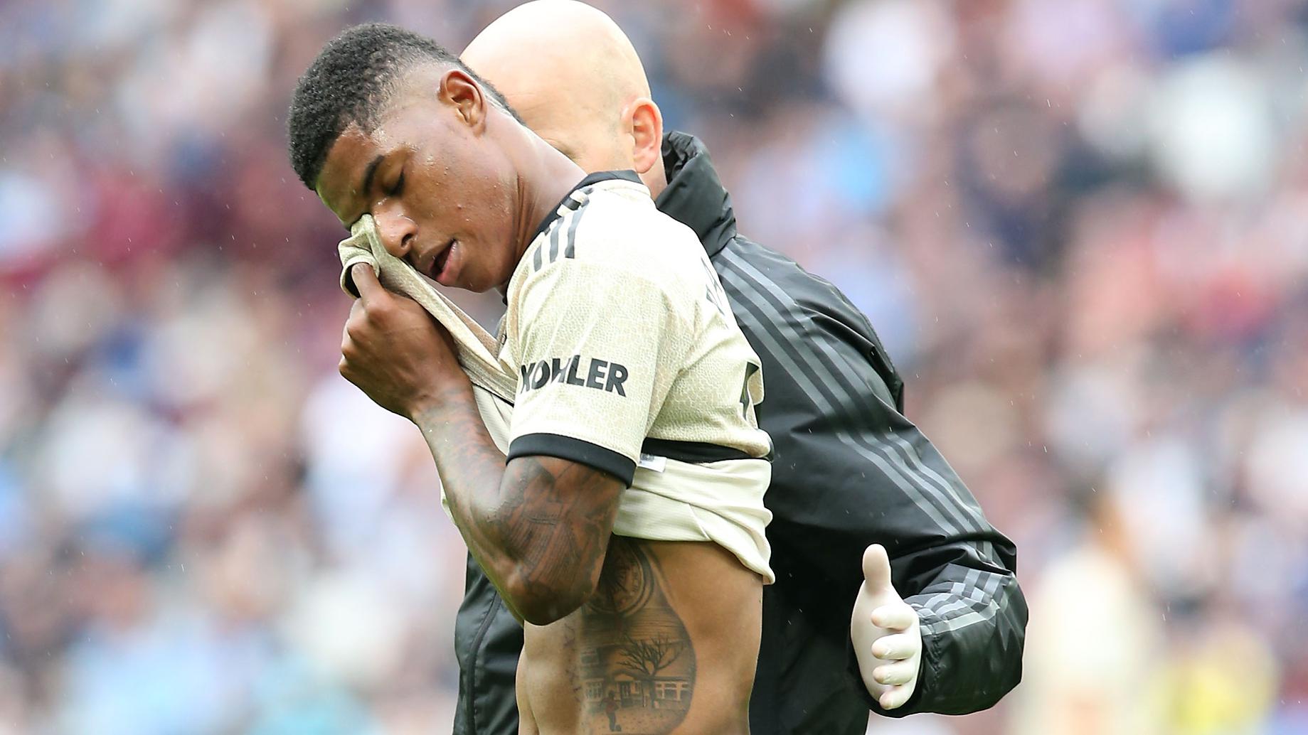 Ole Gunnar Solskjaer Gives Update On Marcus Rashford S Injury Manchester United