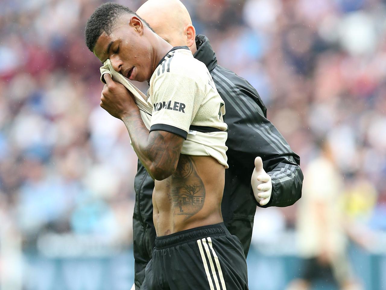 Ole Gunnar Solskjaer Gives Update On Marcus Rashford S Injury Manchester United